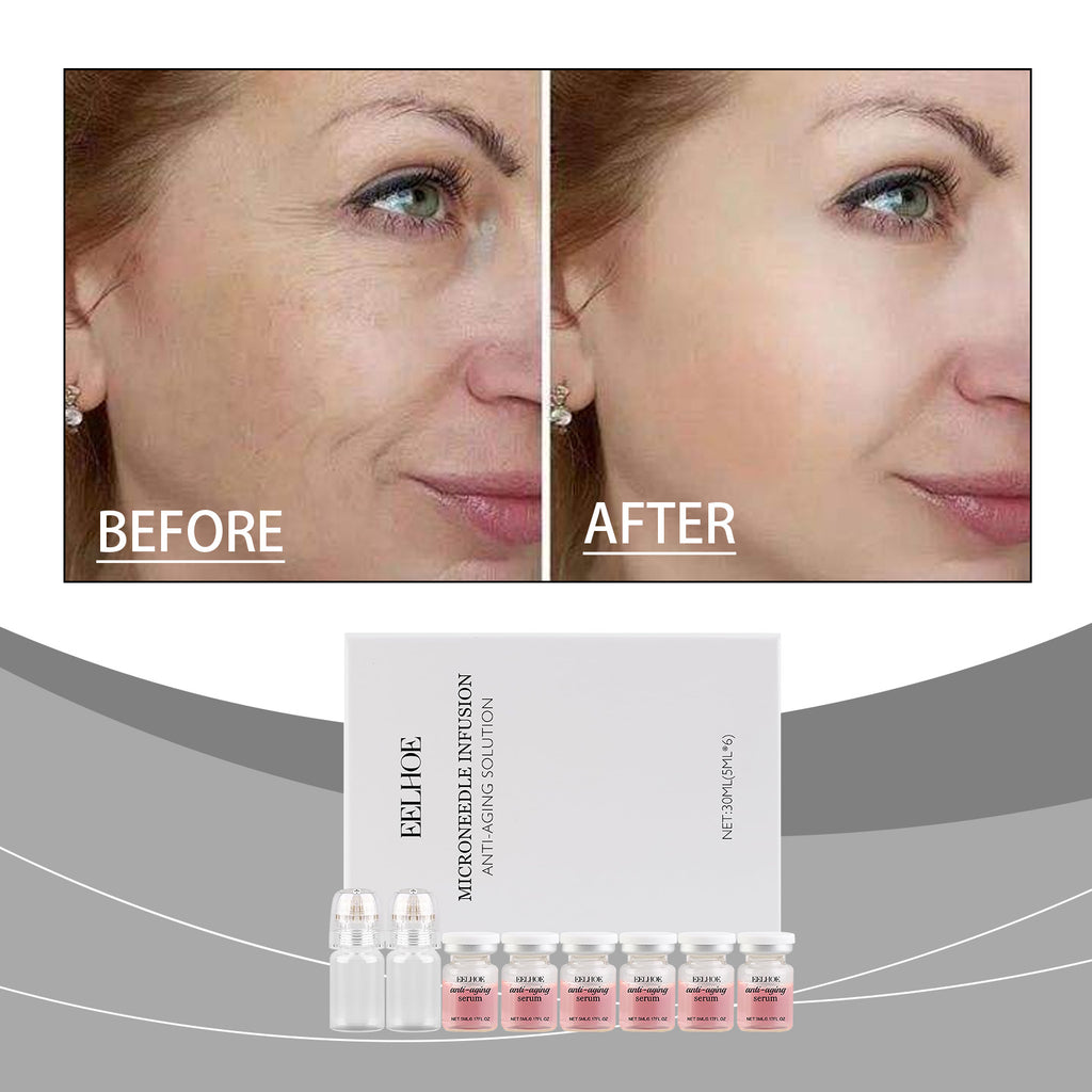 EELHOE Moisturizing Skincare Roller Set – Hydrating & Firming Serum for Fine Line Reduction and Daily Care