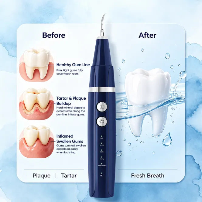 Dailyblisshop Electric Plaque Remover for Teeth at home (ORAL Max) - Dual-Button Oral Care Kit